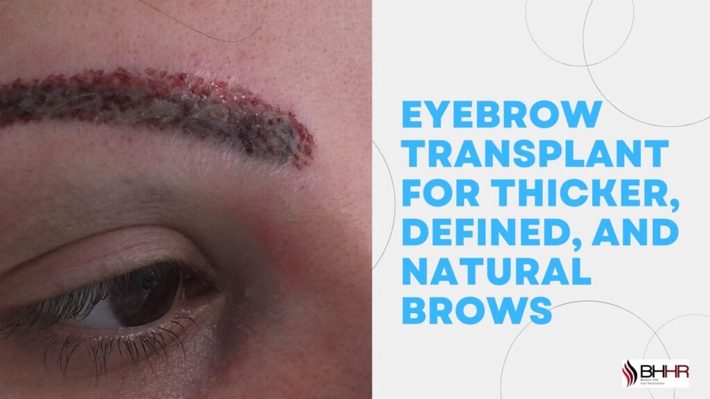 Eyebrow Transplant for Thicker, Defined, and Natural Brows eyebrow transplant