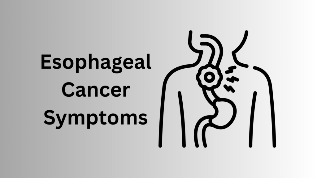 Esophageal Cancer Symptoms: Early Signs You Should Know Esophageal Cancer Symptoms