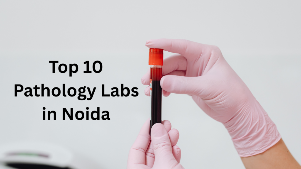 Blood Tests in Noida