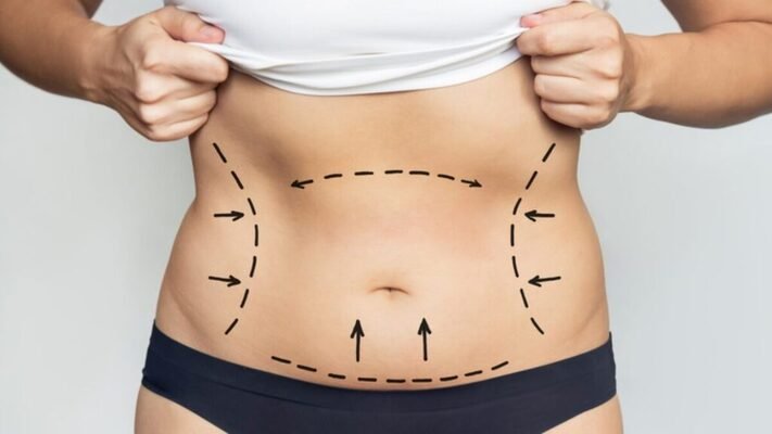 Best Doctors in Dubai for Male and Female Liposuction Procedures liposuction in dubai
