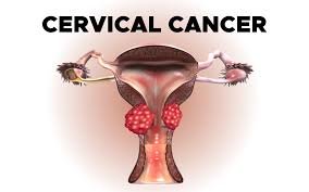 From Diagnosis to Recovery: A Modern Approach to Cervical Cancer Treatment Cervical Cancer treatment