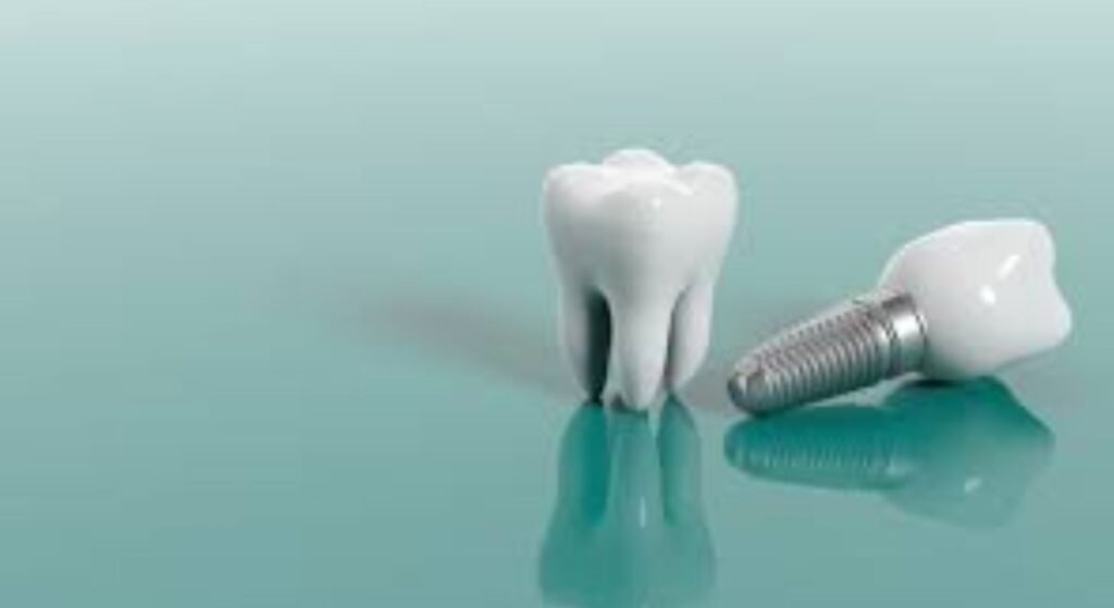 dental implant images