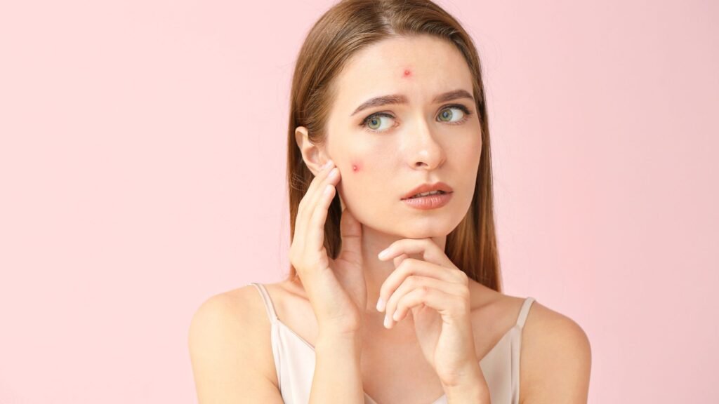 Acne Treatment in Dubai: Combination Therapies for Faster Results