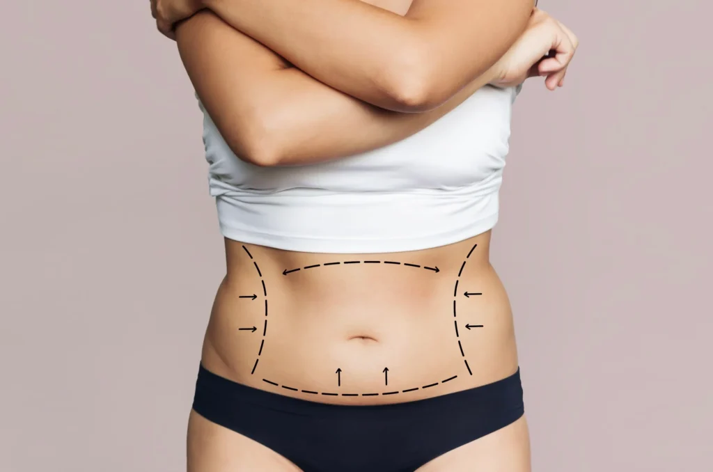 body lift surgery in Dubai