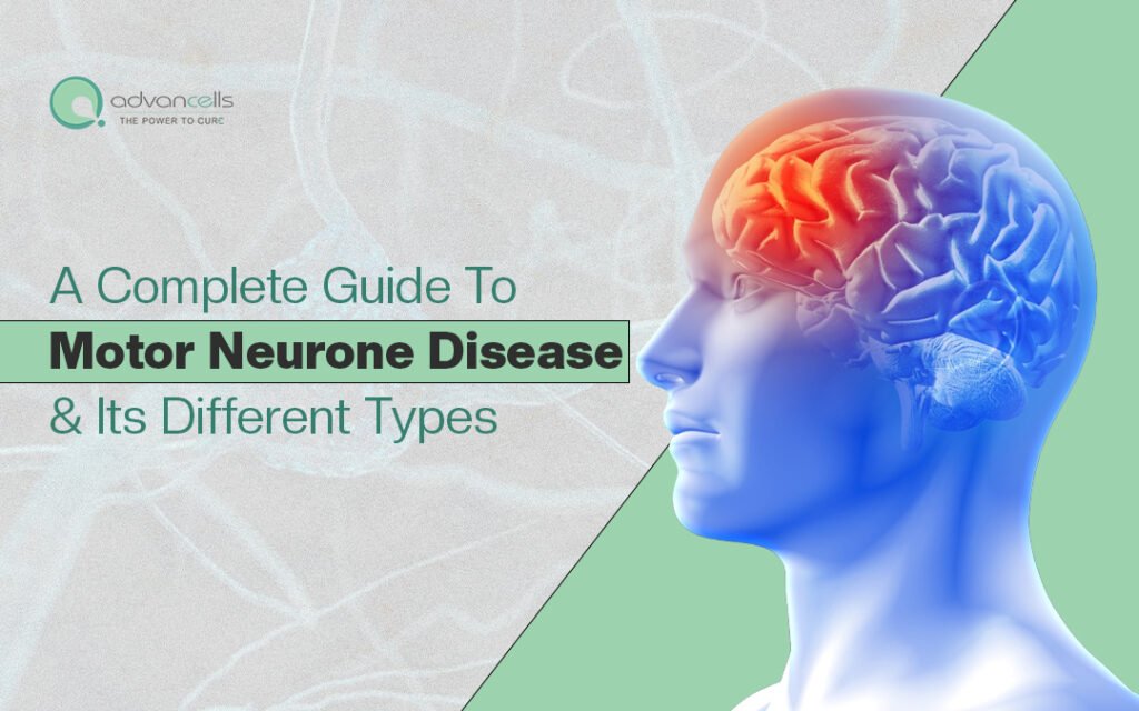 Motor-Neurone-Disease