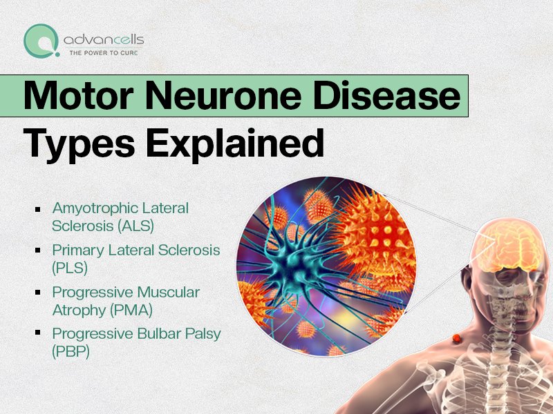 Motor-Neurone-Disease-Types
