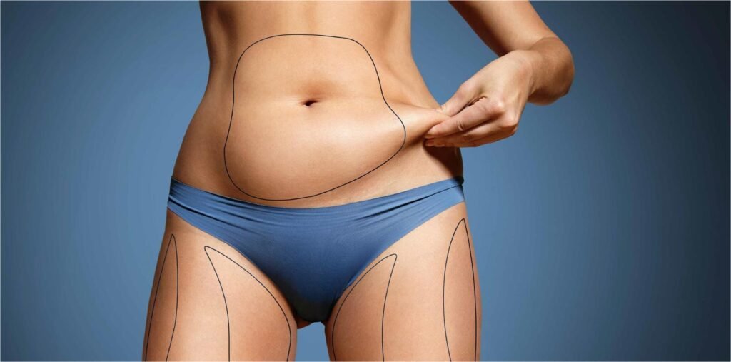 Why Abdominoplasty Dubai Is Popular Among Post-Pregnancy Patients