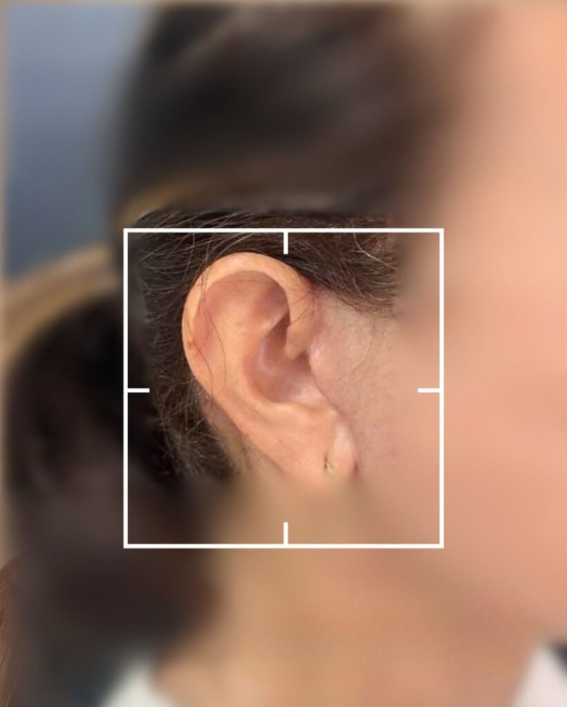 ear reshaping surgery in islamabad