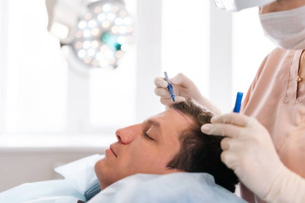 زراعة الشعر في دبي بتقنية الذكاء الاصطناعي لنتائج دقيقة Hair transplant in Dubai