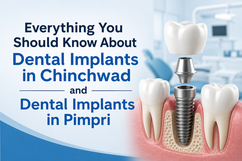 Dental Implants in Chinchwad