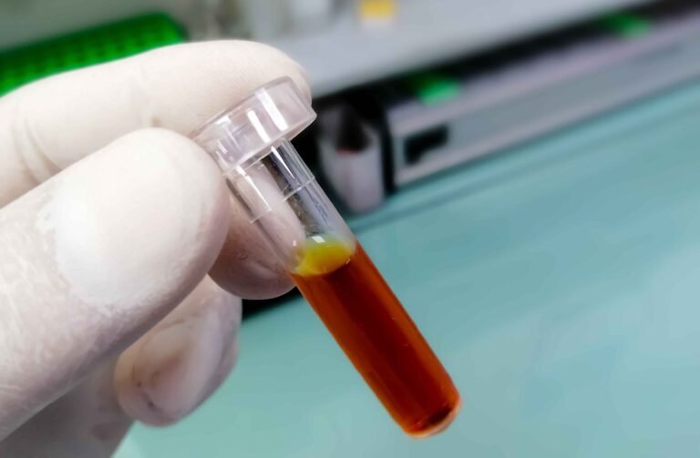 Pemphigus Vulgaris Research (1)