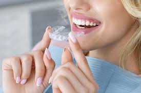 Are Teeth Aligners Affordable?