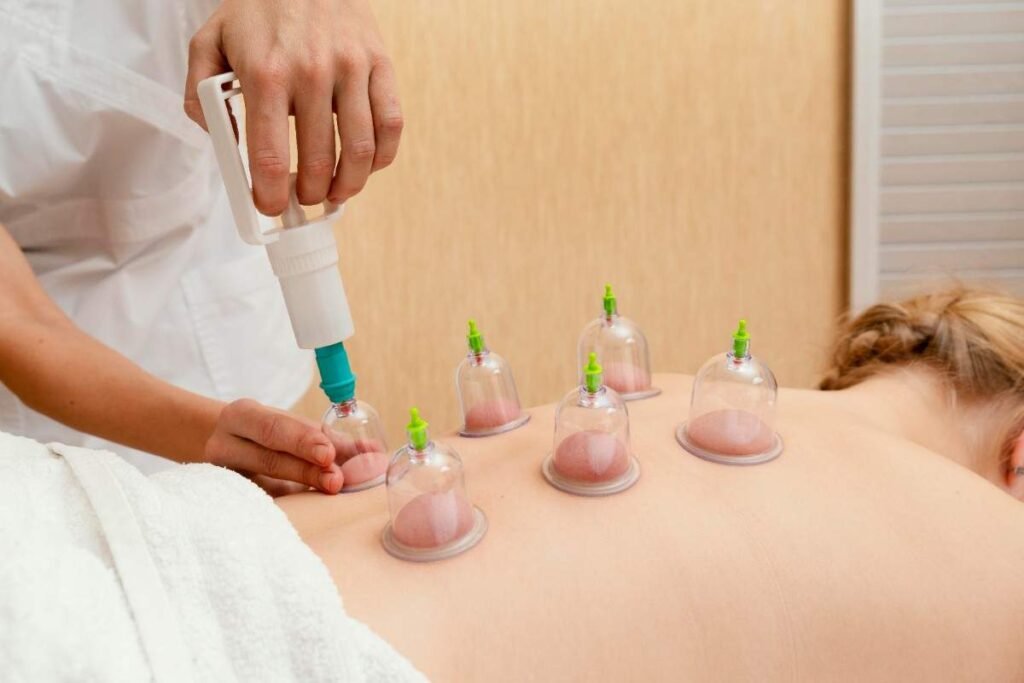 How to Find the Right Cupping Therapy Center Near You? chinese cupping therapy