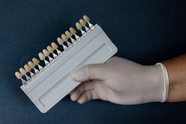 Treatment Packages, What’s Included, and What Patients Should Expect Dental Veneers in Islamabad Pakistan: Treatment Packages, What’s Included, and What Patients Should Expect Dental Veneers in Islamabad Pakistan: