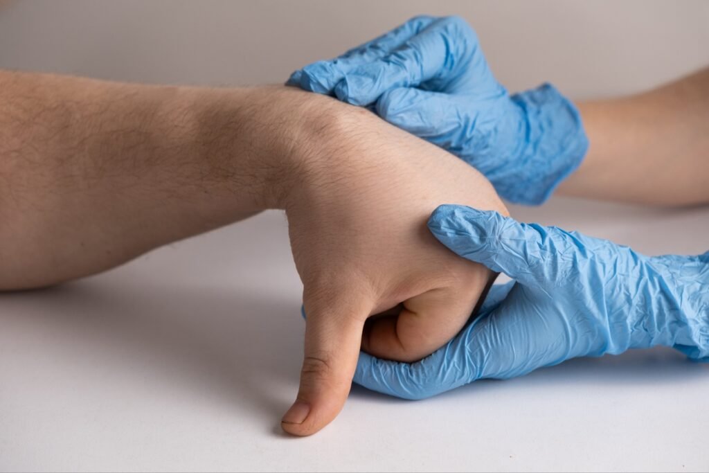 Ganglion Cyst: Diagnosis, Symptoms, and Care Options