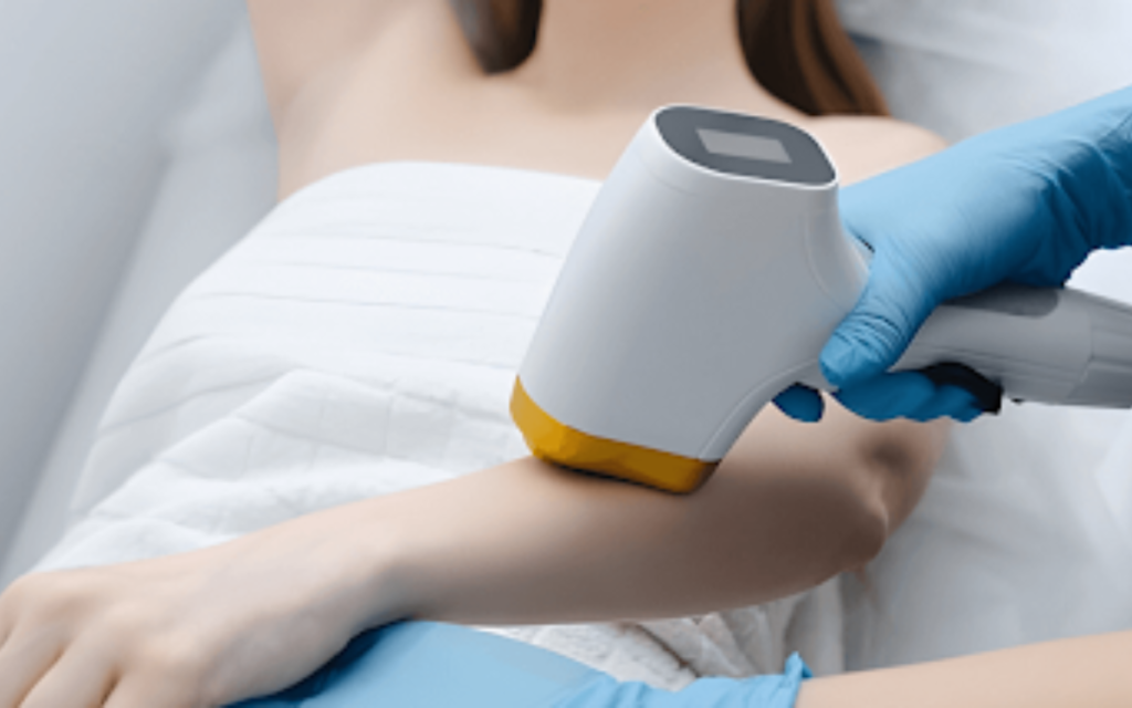 Laser hair removal